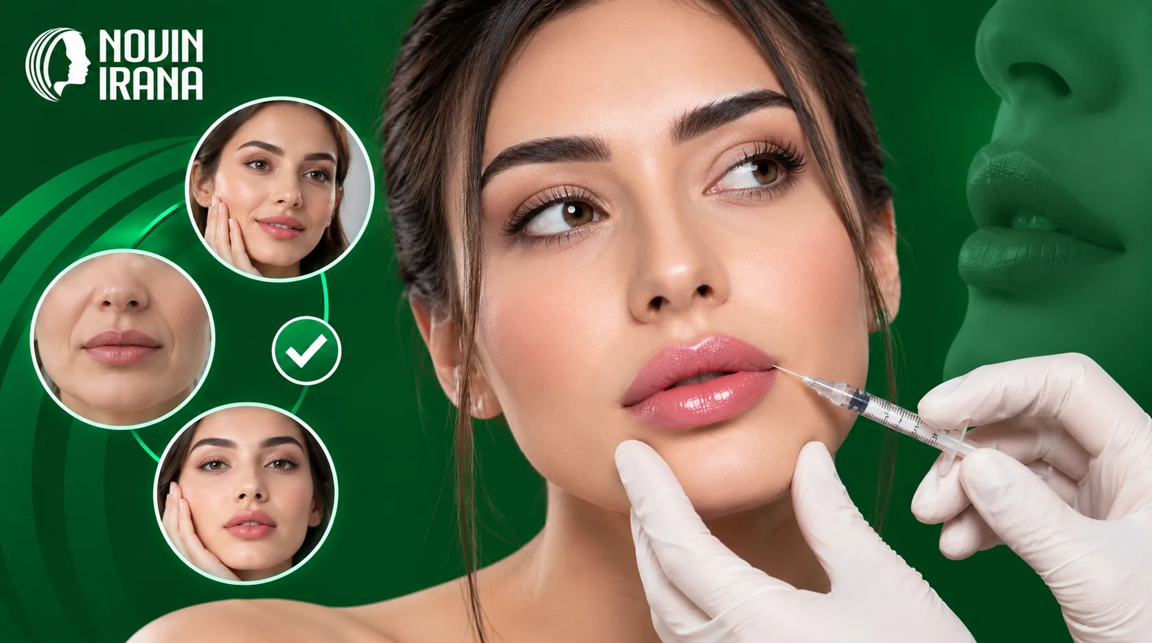 کاندیدای مناسب تزریق ژل لب در مشهد
